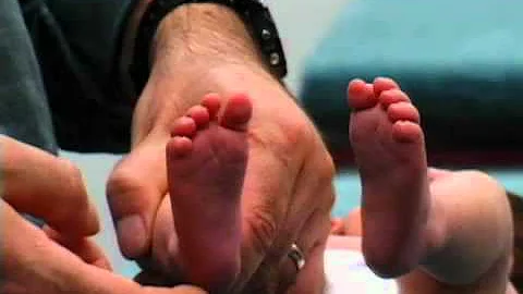 Newborn Reflexes