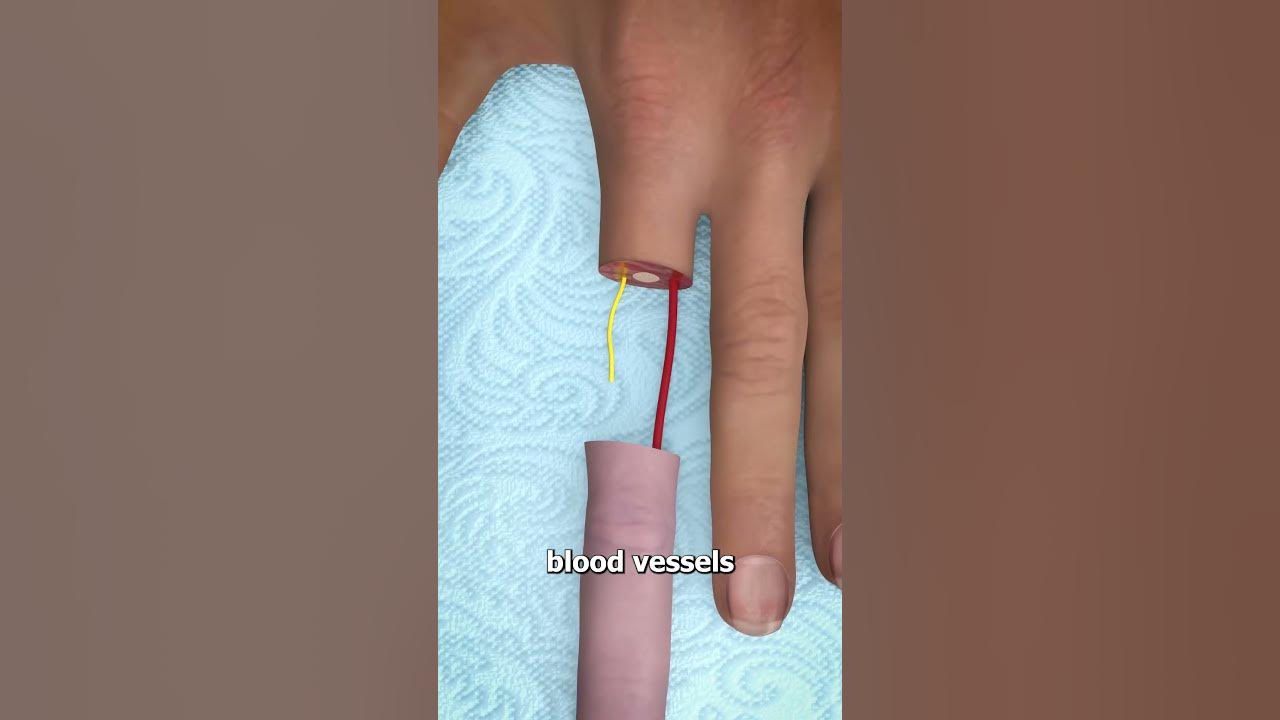 Can You Reattach a Severed Finger? 🤔