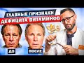 Внешние проявления недостатка витаминов. Витамины A, C, B, D, E, K