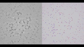 Videos of cells flowing in a microfluidic cell culture device for studying immune cell behavior.