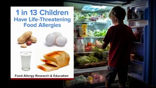 What you should know about food allergen introductions