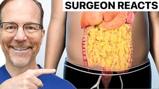 Treatment Options for Type 2 Diabetes | Surgeon Reacts