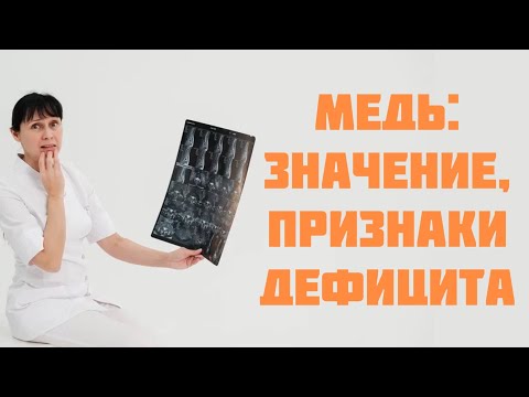 Медь: значение для организма, признаки дефицита Доктор Лисенкова