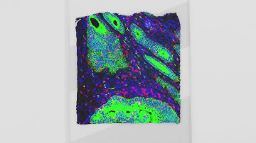 A 360 Degree View of Tumor Biology