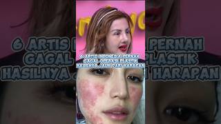Download Lagu 6 Artis Indonesia pernah gagal operasi plastik hasilnya jauh dari harapan#viralshorts#daftarpopuler MP3 Download Lagu 6 Artis Indonesia pernah gagal operasi plastik hasilnya jauh dari harapan#viralshorts#daftarpopuler MP3