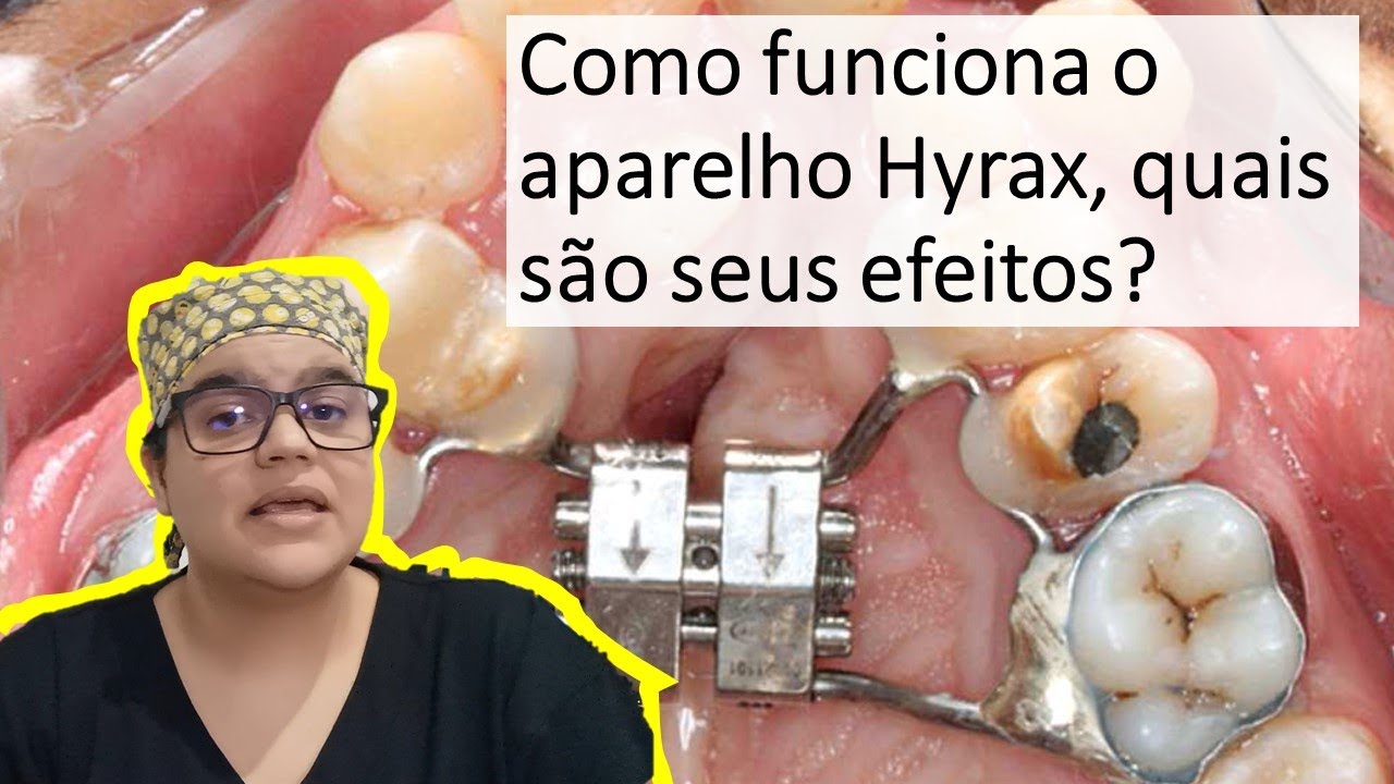 Como saber se o Hyrax está funcionando?| Dra Bianca Rosa