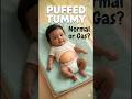 The Truth About Your Baby’s Rounded Tummy!🧐