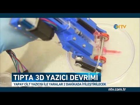 Video: Taşınabilir Bir 3D Cilt Yazıcı Derin Yaraların Iyileşmesine Yardımcı Olabilir