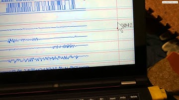 Arduinoと三軸加速度センサ