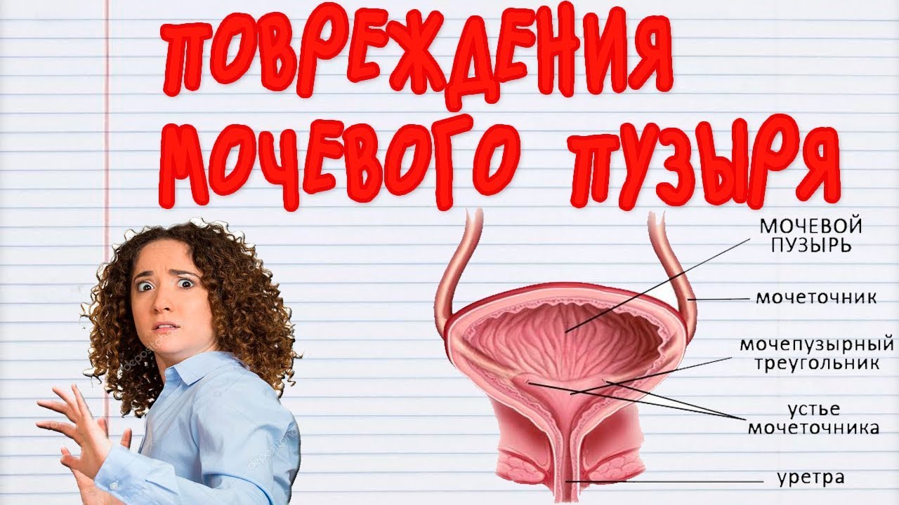 МОЧЕВОЙ ПУЗЫРЬ. Какие бывают ПОВРЕЖДЕНИЯ МОЧЕВОГО ПУЗЫРЯ. Профилактика Повреждений Мочевого Пузыря!