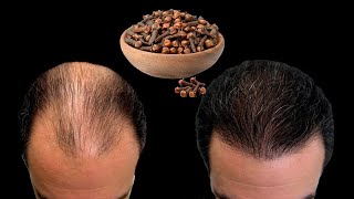 Haar Groeit Snel En Valt Niet Uit - Rozemarijn Voor De Haargroei Dat Is De Beste Remedie