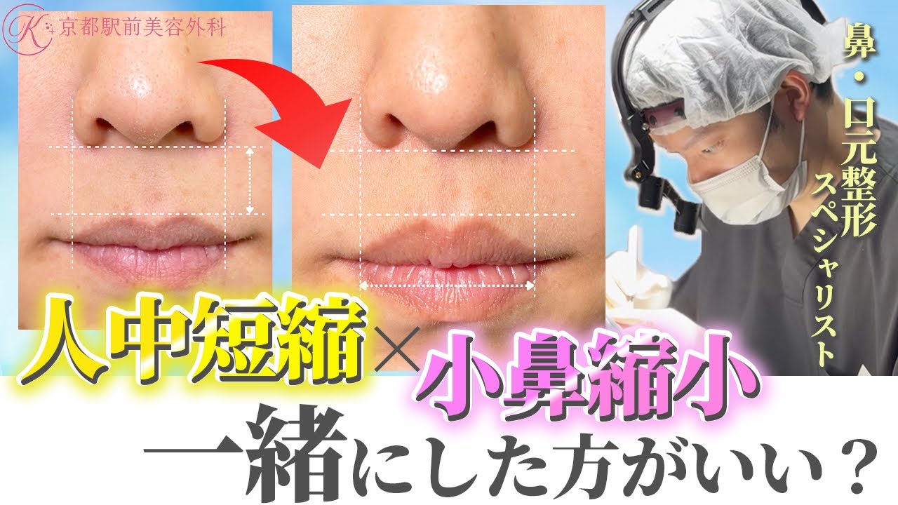 人中短縮と小鼻縮小を一緒にした方がいい人は？