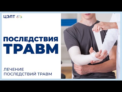 ♿ Последствия травм. Лечение последствий травм. ЦЭЛТ.