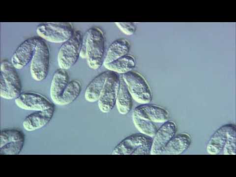 Videó: A Gasztrointesztinális Traktus Protozoa Mikroorganizmusai Patkányokban