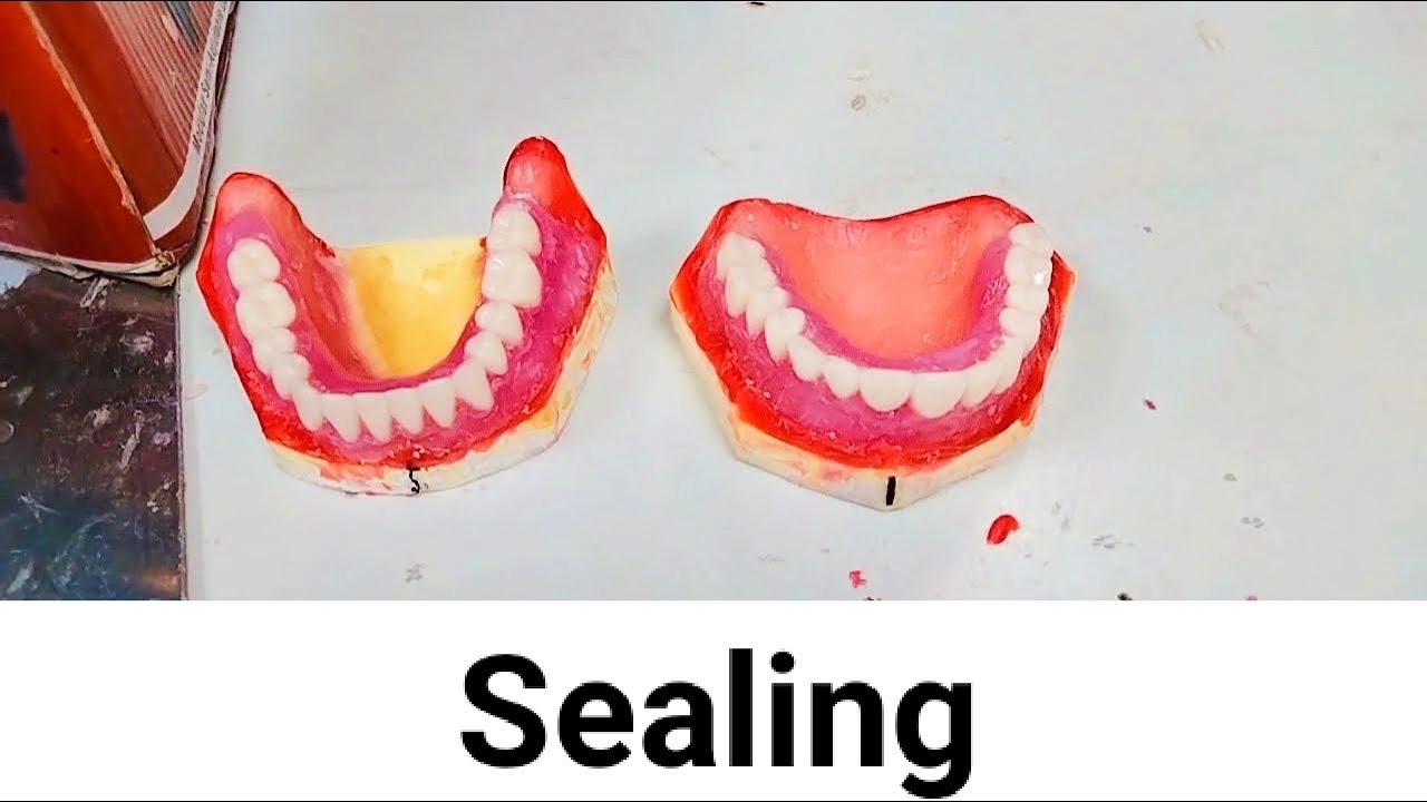Step 11 Sealing // seal the model with wax complete_denture YouTube