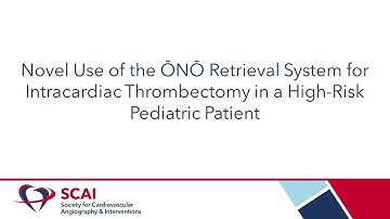 Dr. Aravinth Karunanandaa  presents Novel Use of the ŌNŌ Retrieval System at SCAI 2023