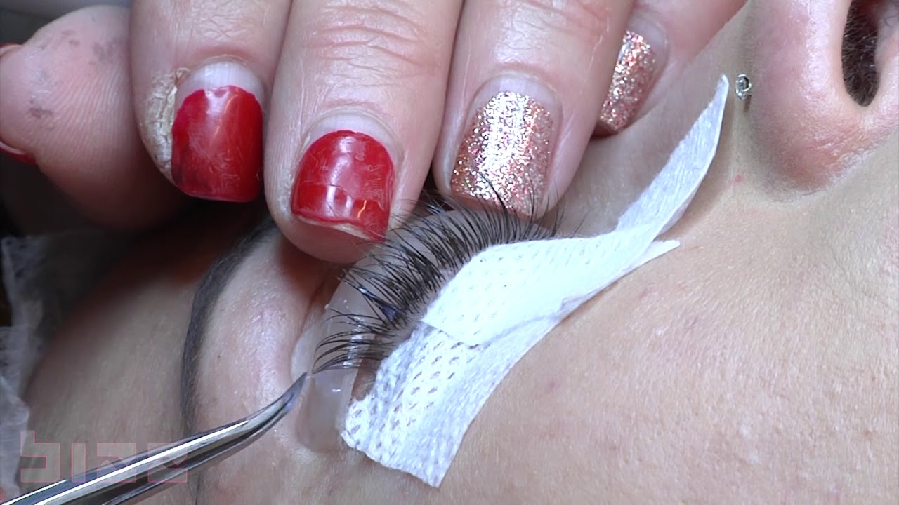 BIZZ-Lakimi i qerpikëve,trend i ri