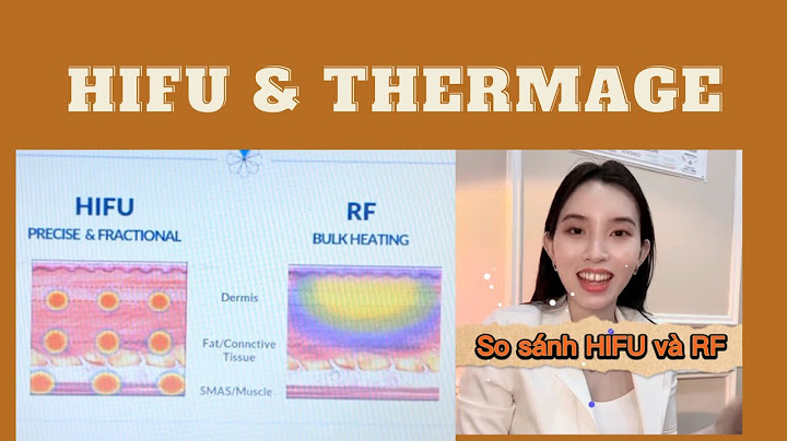 So sánh công nghệ hifu và ultherapy webtretho