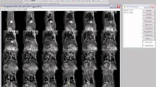 Manual segmentation of mouse lungs using ImageJ.
