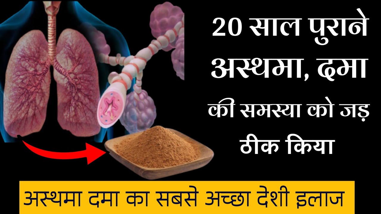 asthma treatment asthma treatment in hindi अस्थमा का आयुर्वेदिक