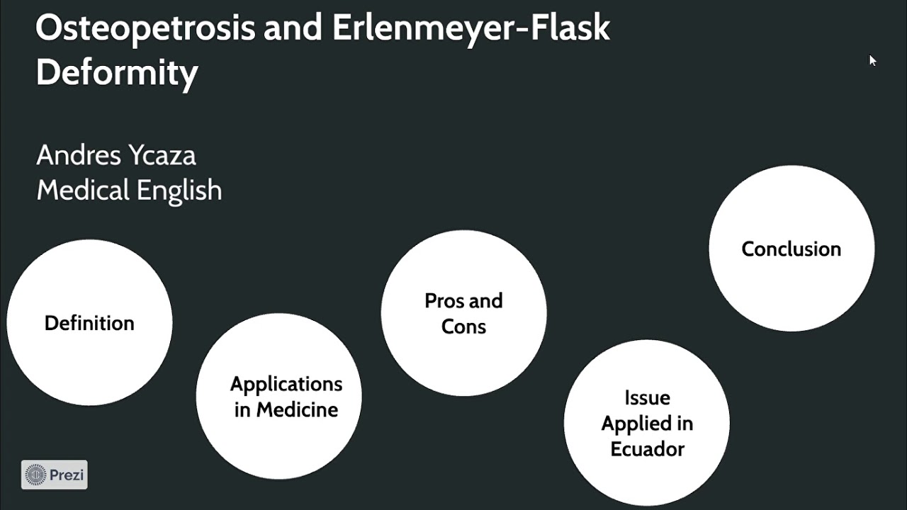 Osteopetrosis and Erlenmeyer Flask Deformity YouTube