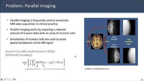Deep Learning for MRI reconstruction