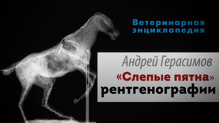Слепые пятна рентгенографии