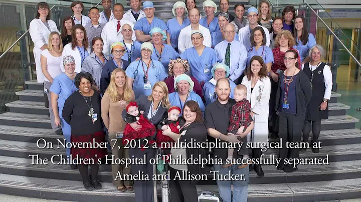 Conjoined Twins Successfully Separated at The Chil...