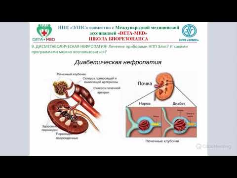 Дисметаболическая нефропатия 2021.03.17