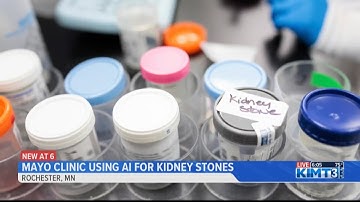 AI helping people with kidney stones