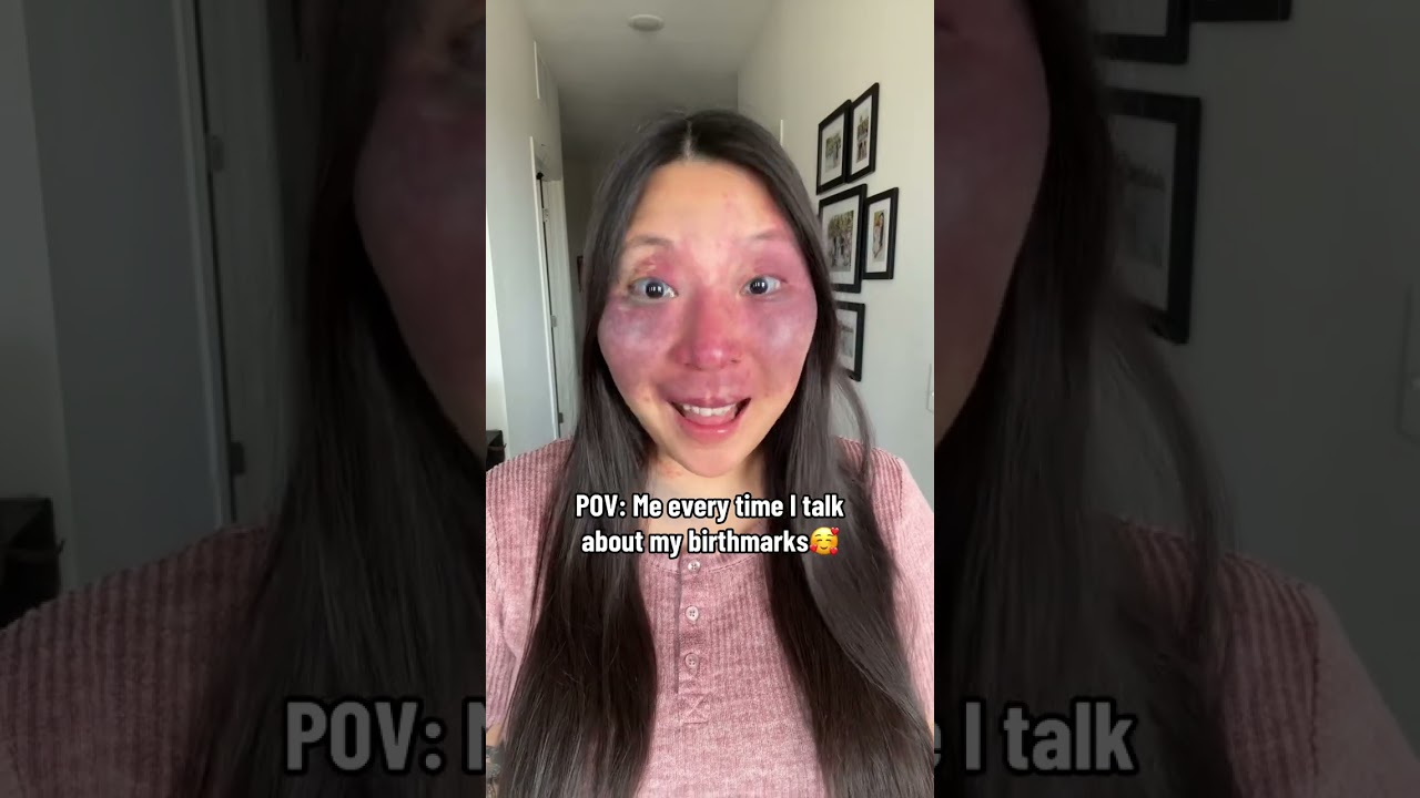 And I will keep telling my story again and again!🥰 