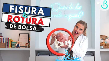 ¿Duele la rotura de aguas?