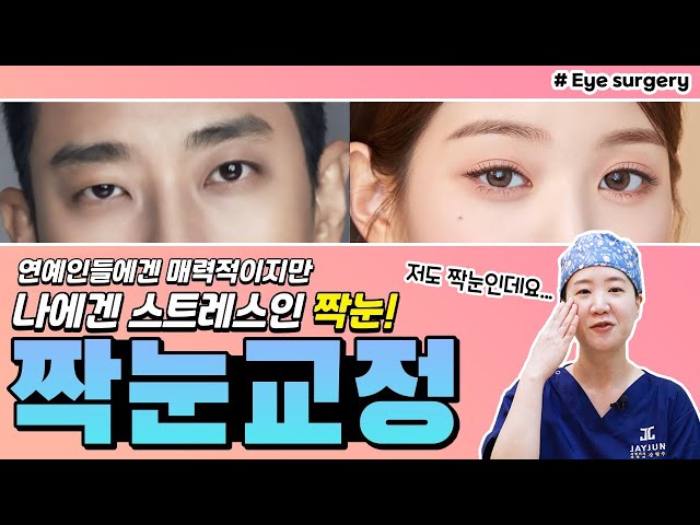 짝눈 때문에 고민이라면 영상 꼭 보세요! 유형에 따라 해결방법을 알려드립니다!