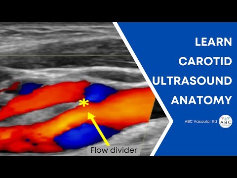 Carotid artery Doppler ultrasound test. How to perform a basic ultrasound carotid examination.