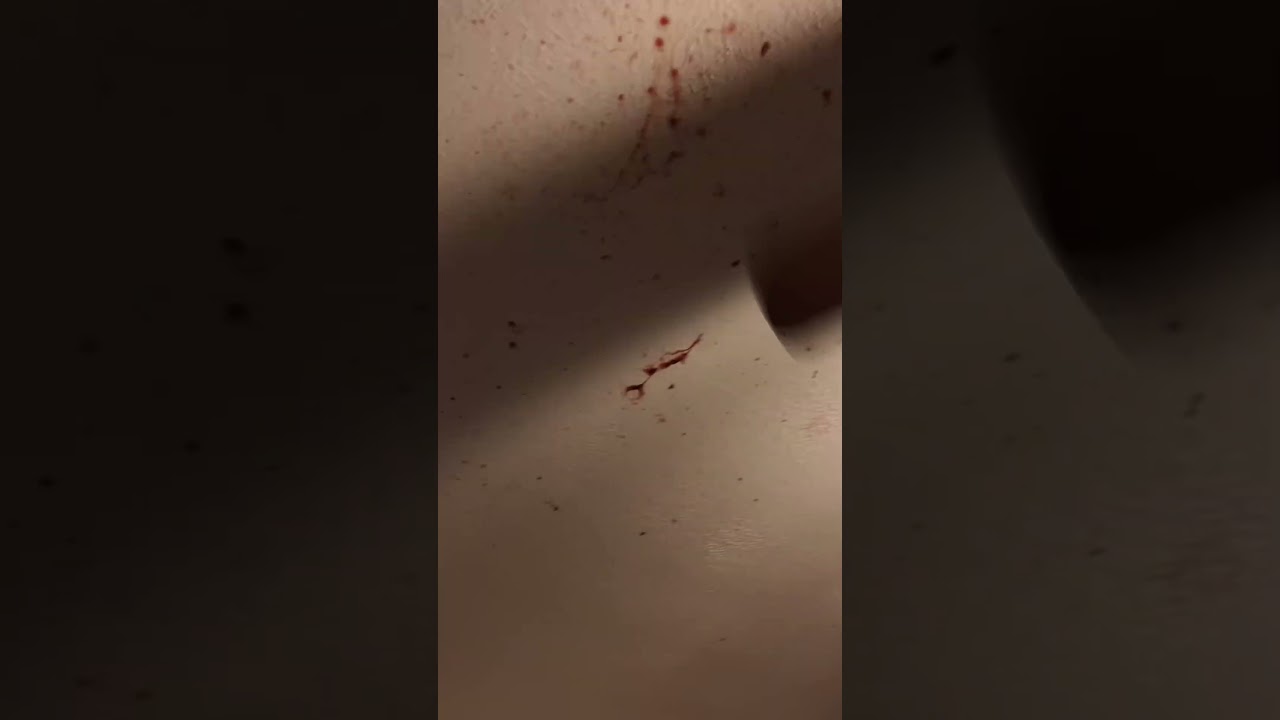 Crime Scene Cleanup: Blood on the Ceiling (We Feel It)