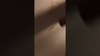 Crime Scene Cleanup: Blood on the Ceiling (We Feel It)