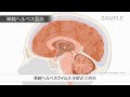 目で見る病気 第3版 VOL.15 脳・神経の疾患