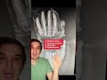OSHA Violation Osha Medicine Doctor Doctors Doctorsoftiktok Medstudent Medicalstudent OSHA Violation Osha Medicine Doctor Doctors Doctorsoftiktok Medstudent Medicalstudent