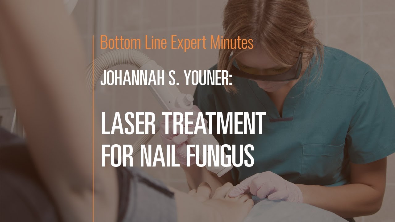 Laser Treatment for Nail Fungus YouTube
