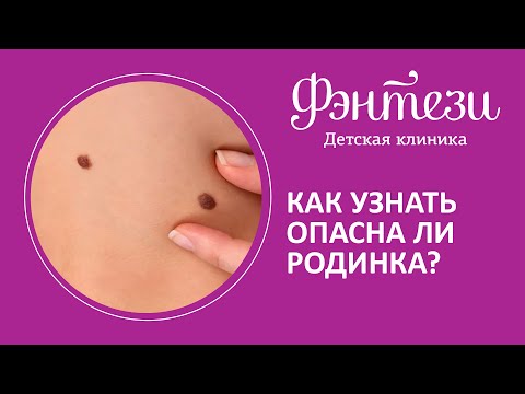 Как узнать опасна ли родинка❓🤔