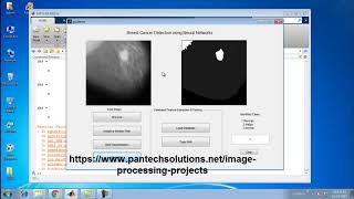 Breast Cancer detection using Neural Networks -Image processing project