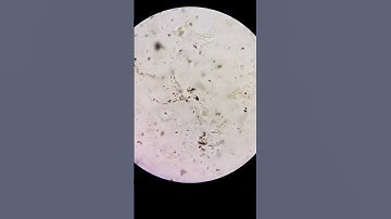 Is the Urine normal? #laboratory #mls #cls #medtechstudent