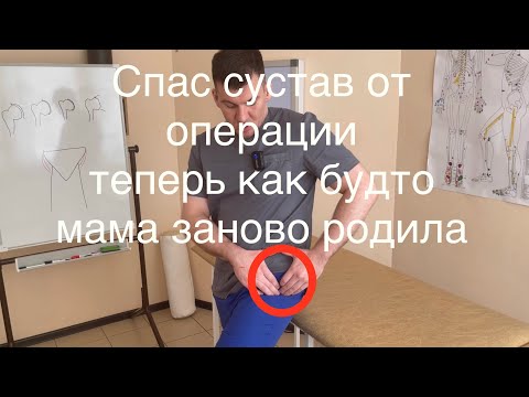 Видео: Сообщается ли сумка подвздошно-поясничной мышцы с тазобедренным суставом?