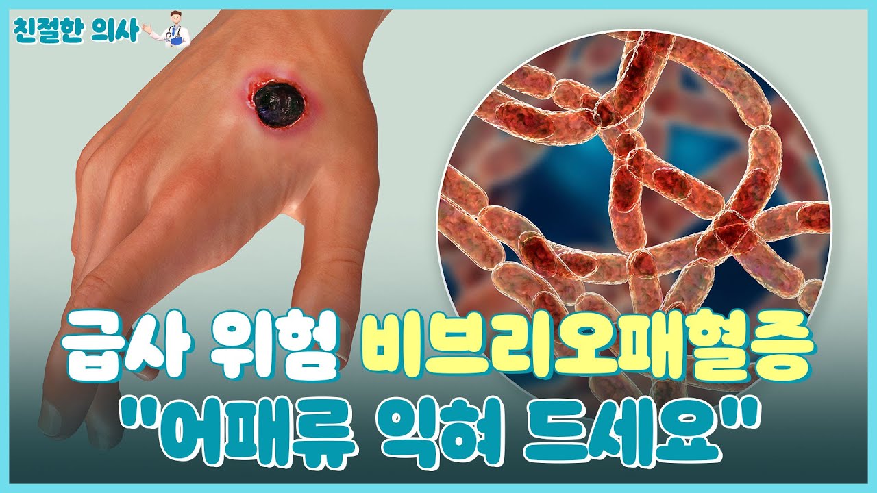 '치사율 50%' 비브리오패혈증⋯