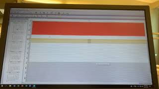 How to Schedule a Restorative Appointment on Eaglesoft