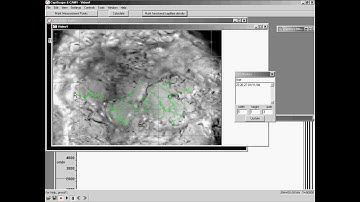 Functional capillary density measured by CapiScope software.