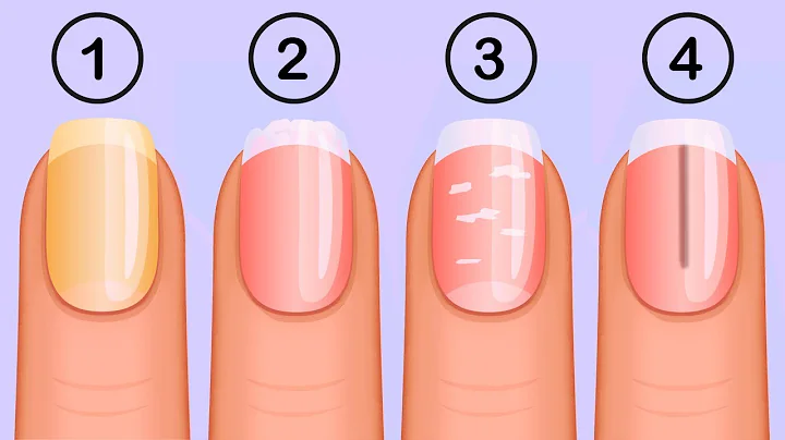 5 Things Your Nails Can Tell You About Your Health - DayDayNews