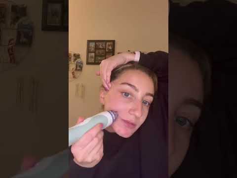 Personal Microdermabrasion: Unclog