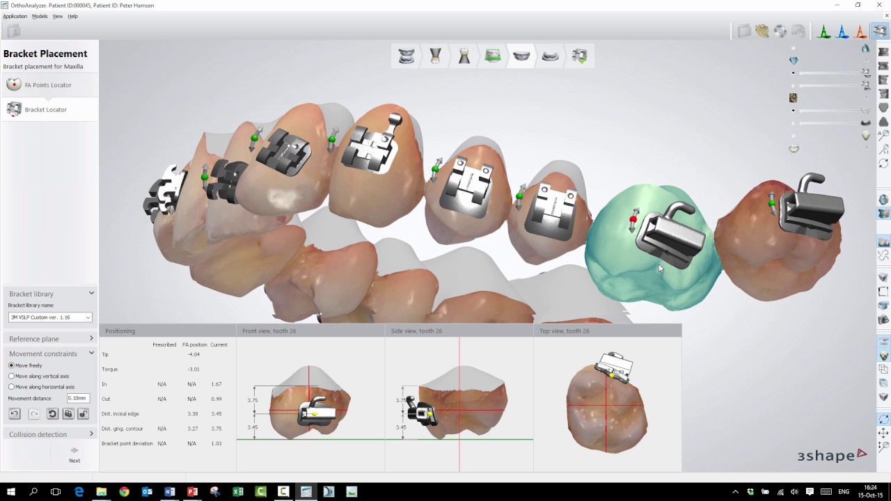 3Shape Ortho Analyzer How to Use the Bracket Placement Workflow YouTube