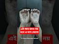 এই ক্ষত হাতে নয়, মনেও দাগ ফেলে দেয়🙌 | Real Skin Recovery | Before &amp; After"| Dr. Shoeb Hossain